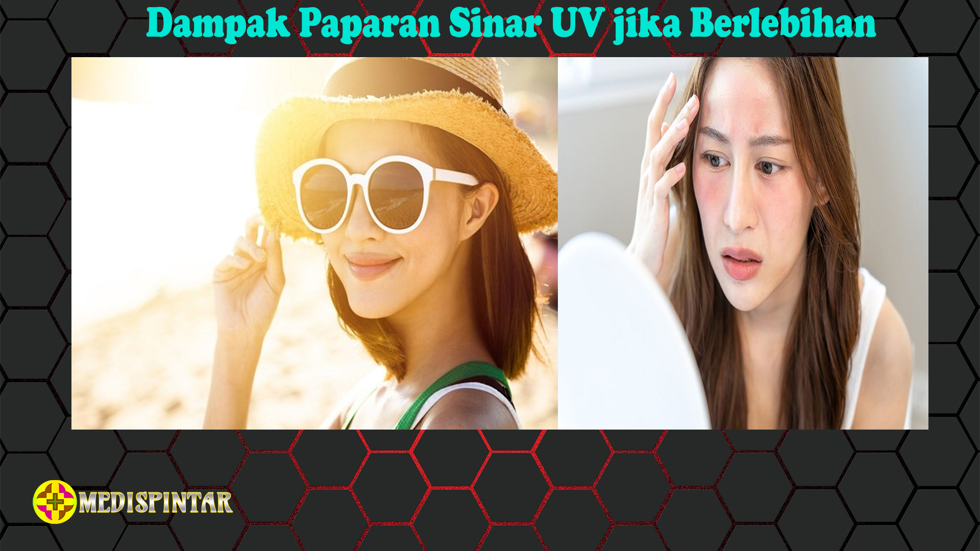 Dampak Paparan Sinar UV jika Berlebihan